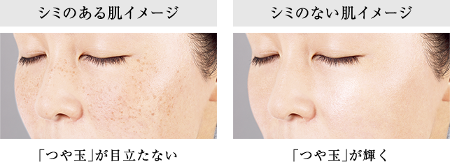 シミのある肌イメージ シミのない肌イメージ