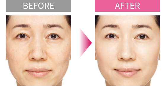 BEFORE AFTER